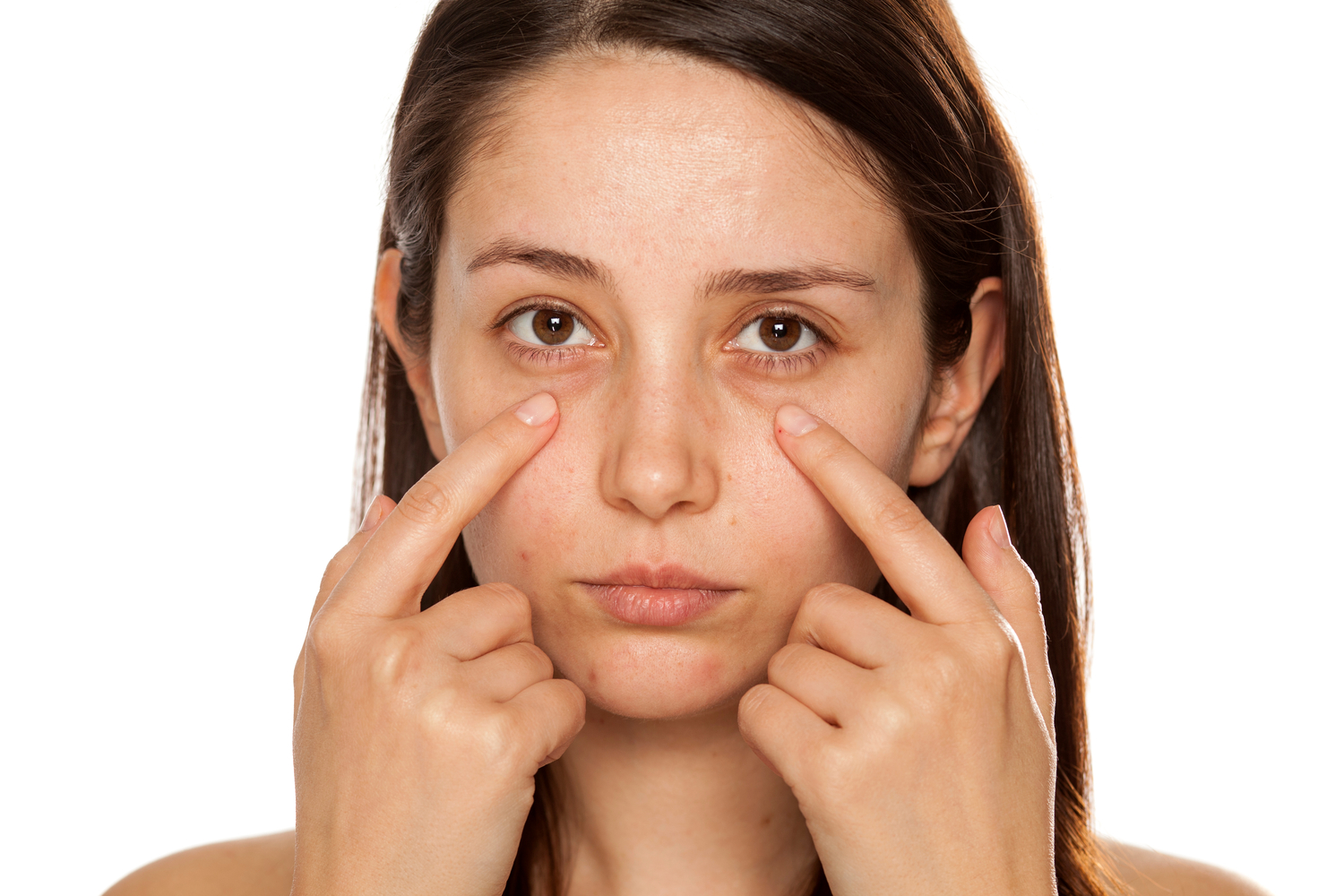 How To Get Rid of Those Dark Circles Under Your Eyes